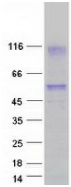 Coomassie blue staining of purified HAVCR1 protein.